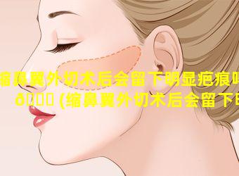 缩鼻翼外切术后会留下明显疤痕吗 🐟 (缩鼻翼外切术后会留下明显疤痕吗图片)